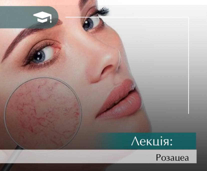 Інєкційні техніки