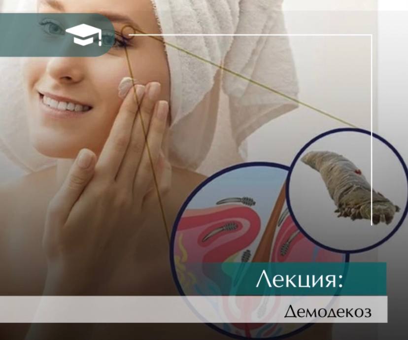 Інєкційні техніки