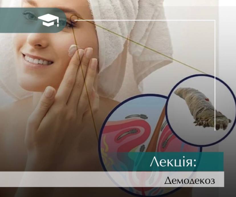 Інєкційні техніки