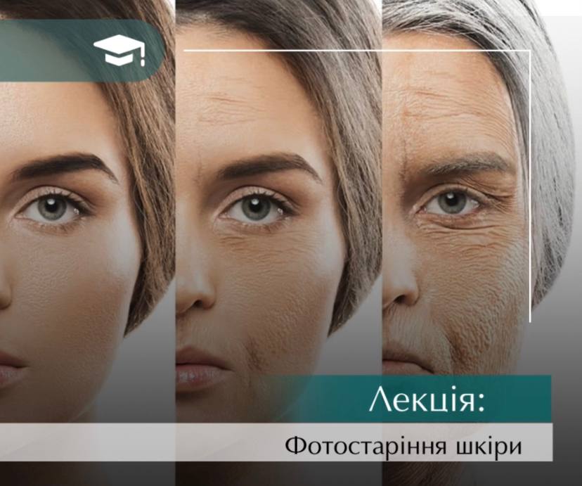 Інєкційні техніки