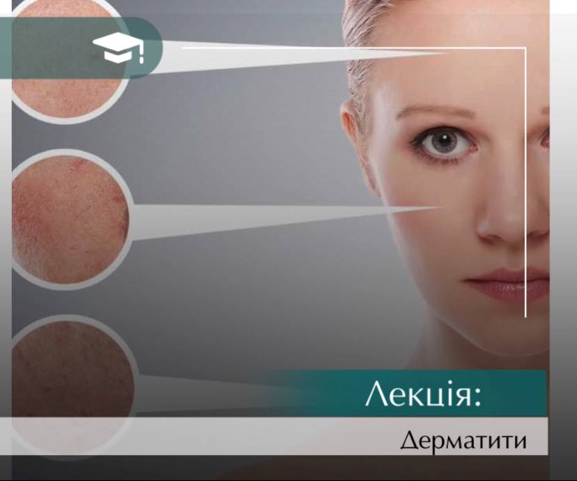 Інєкційні техніки