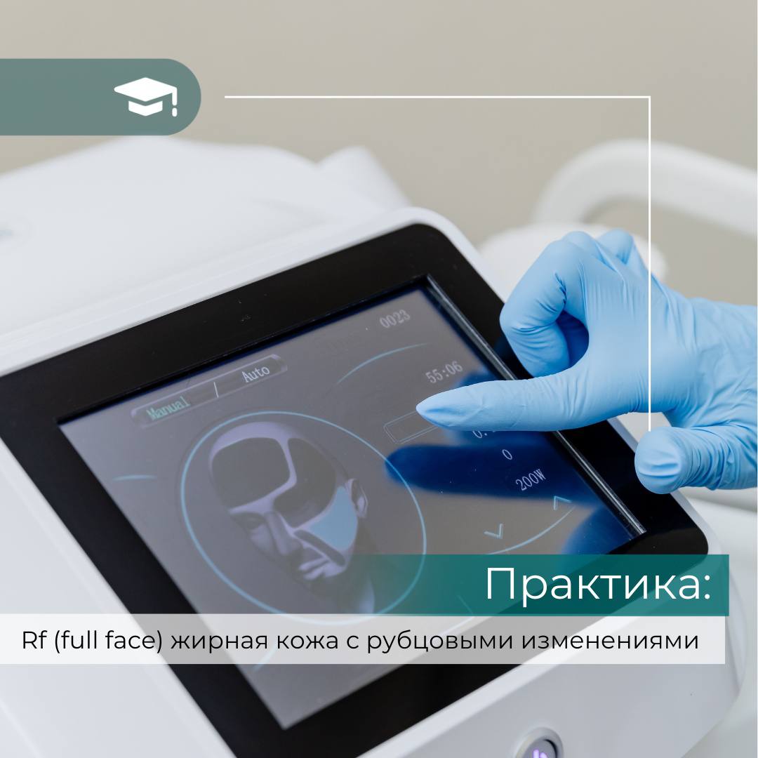 Чистка обличчя 