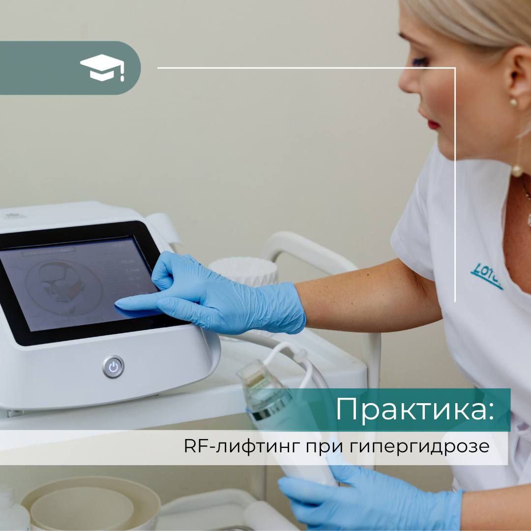 Практика: Микроигольчатый RF-лифтинг при гипергидрозе